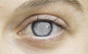 Glaucoma Surgery